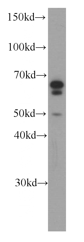 PC-3 cells were subjected to SDS PAGE followed by western blot with Catalog No:107422(MLPH antibody) at dilution of 1:1000