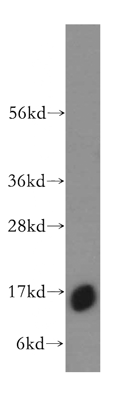 K-562 cells were subjected to SDS PAGE followed by western blot with Catalog No:111276(HBZ antibody) at dilution of 1:300