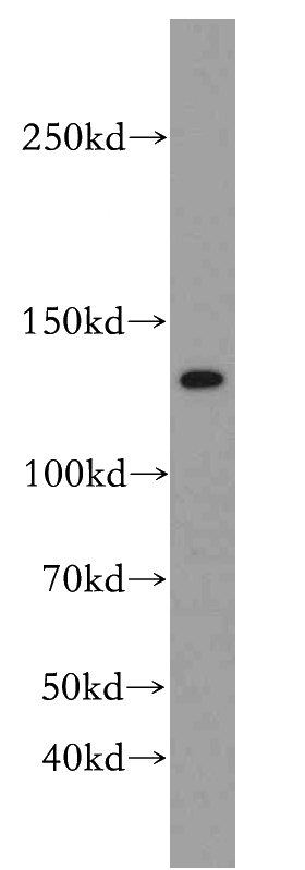 L02 cells were subjected to SDS PAGE followed by western blot with Catalog No:113712(PER2 antibody) at dilution of 1:100