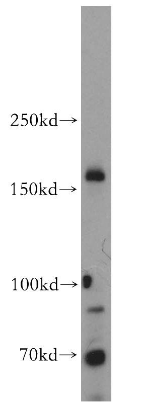 mouse colon tissue were subjected to SDS PAGE followed by western blot with Catalog No:112787(MTMR4 antibody) at dilution of 1:500