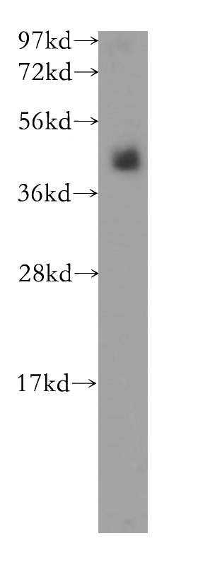 human skin tissue were subjected to SDS PAGE followed by western blot with Catalog No:112140(CD207 antibody) at dilution of 1:500