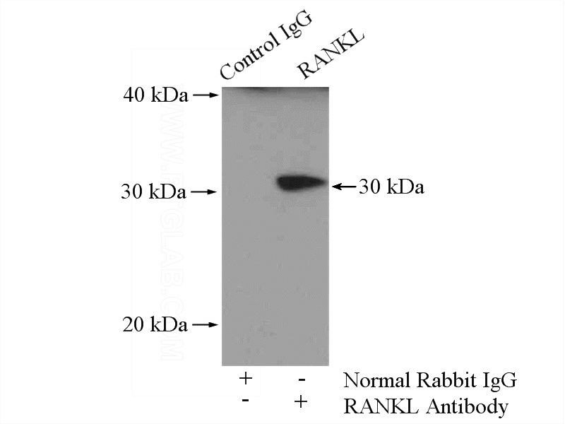 IP Result of anti-RANKL (IP:Catalog No:114544, 4ug; Detection:Catalog No:114544 1:300) with COLO 320 cells lysate 2000ug.