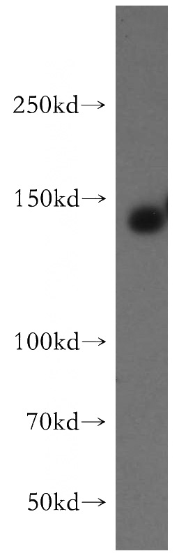 mouse brain tissue were subjected to SDS PAGE followed by western blot with Catalog No:110403(ERBB4 antibody) at dilution of 1:400