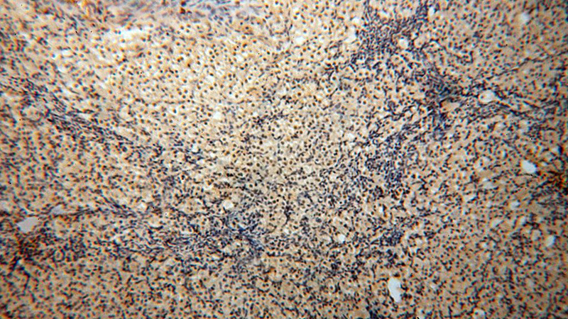 Immunohistochemical of paraffin-embedded human ovary using Catalog No:114590(RBBP4 antibody) at dilution of 1:50 (under 10x lens)