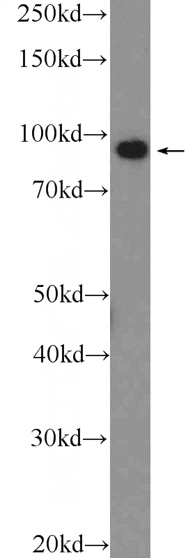 Jurkat cells were subjected to SDS PAGE followed by western blot with Catalog No:113768(ALIX; AIP1 Antibody) at dilution of 1:1000