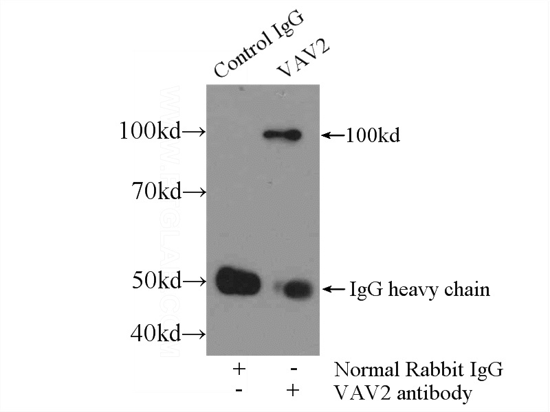IP Result of anti-VAV2 (IP:Catalog No:116722, 4ug; Detection:Catalog No:116722 1:1000) with HeLa cells lysate 2500ug.