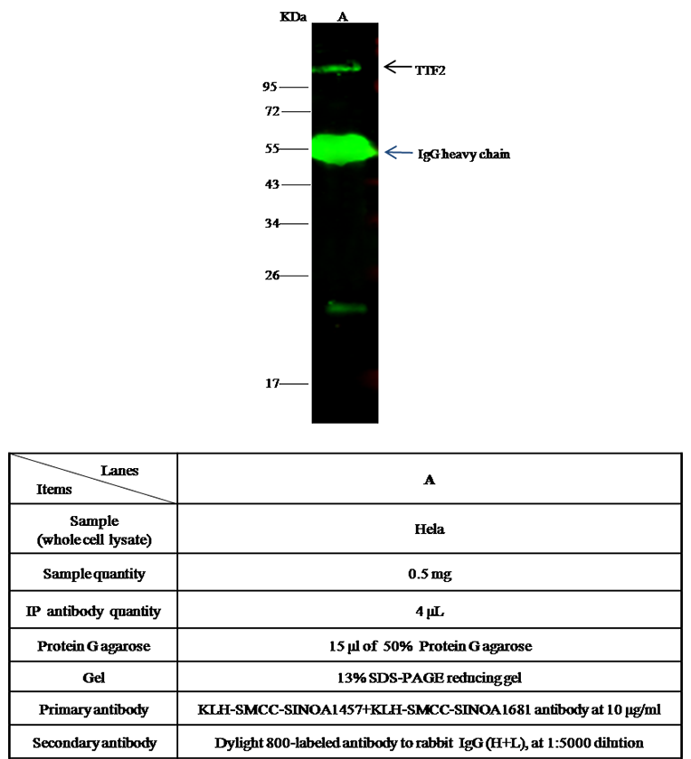 Human TTF2 Immunoprecipitation(IP) 14623