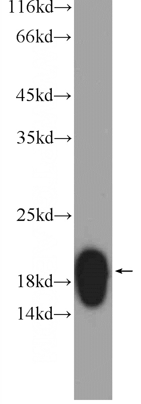 mouse skin tissue were subjected to SDS PAGE followed by western blot with Catalog No:109894(DPT Antibody) at dilution of 1:1000