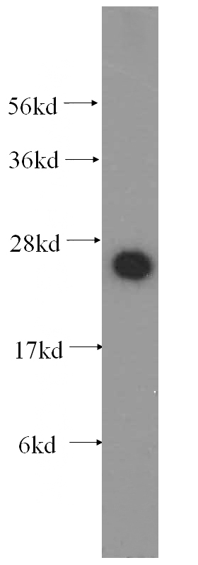human brain tissue were subjected to SDS PAGE followed by western blot with Catalog No:113360(NUDT21 antibody) at dilution of 1:500
