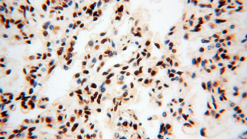 Immunohistochemical of paraffin-embedded human lung using Catalog No:115457(SNRPA1 antibody) at dilution of 1:100 (under 40x lens)