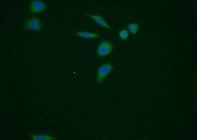 Immunofluorescent analysis of MCF-7 cells using Catalog No:114341(PUS1 Antibody) at dilution of 1:25 and Alexa Fluor 488-congugated AffiniPure Goat Anti-Rabbit IgG(H+L)