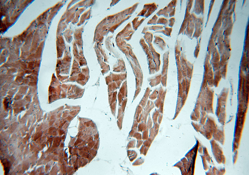 Immunohistochemical of paraffin-embedded human skeletal muscle using Catalog No:113089(NEB-Specific antibody) at dilution of 1:50 (under 10x lens)