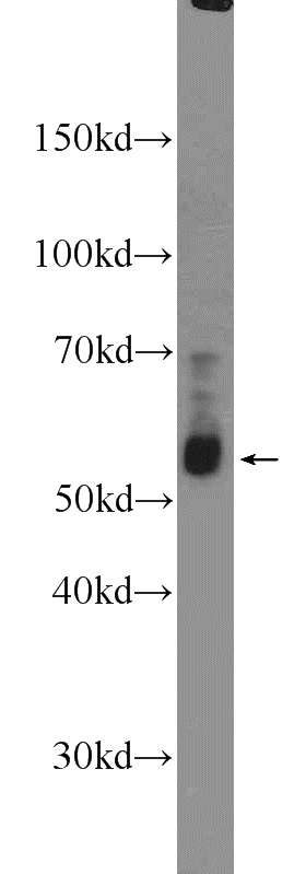 K-562 cells were subjected to SDS PAGE followed by western blot with Catalog No:110880(GATA3 Antibody) at dilution of 1:300