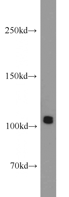 Jurkat cells were subjected to SDS PAGE followed by western blot with Catalog No:108206(ERAP1 antibody) at dilution of 1:1000