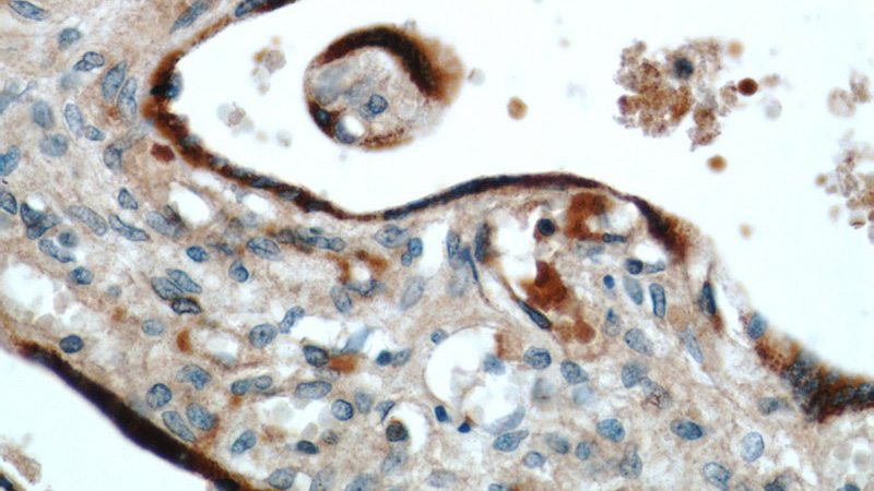Immunohistochemical of paraffin-embedded human placenta using Catalog No:110963(GH2 antibody) at dilution of 1:50 (under 40x lens)