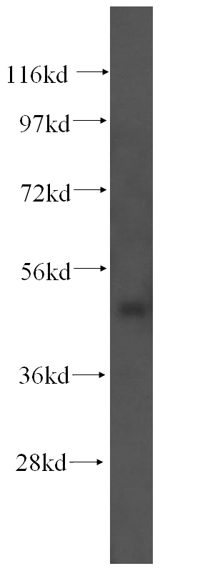 HEK-293 cells were subjected to SDS PAGE followed by western blot with Catalog No:115939(TEKT4 antibody) at dilution of 1:500