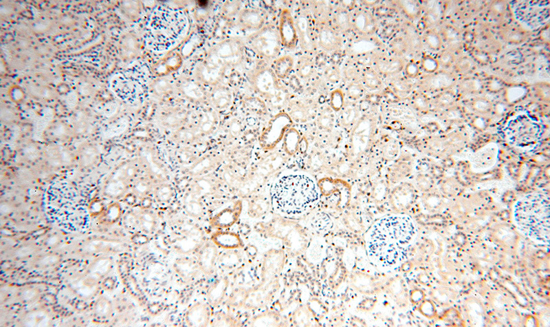 Immunohistochemical of paraffin-embedded human kidney using Catalog No:107788(ADH4 antibody) at dilution of 1:50 (under 10x lens)