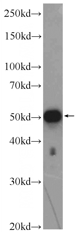 HeLa cells were subjected to SDS PAGE followed by western blot with Catalog No:117021(ZNF689 Antibody) at dilution of 1:600