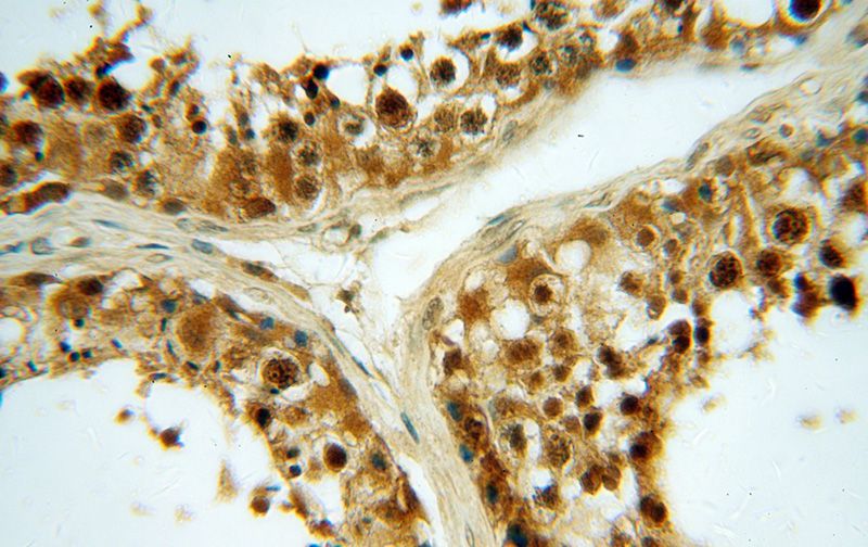 Immunohistochemical of paraffin-embedded human testis using Catalog No:113539(P19 antibody) at dilution of 1:50 (under 40x lens)