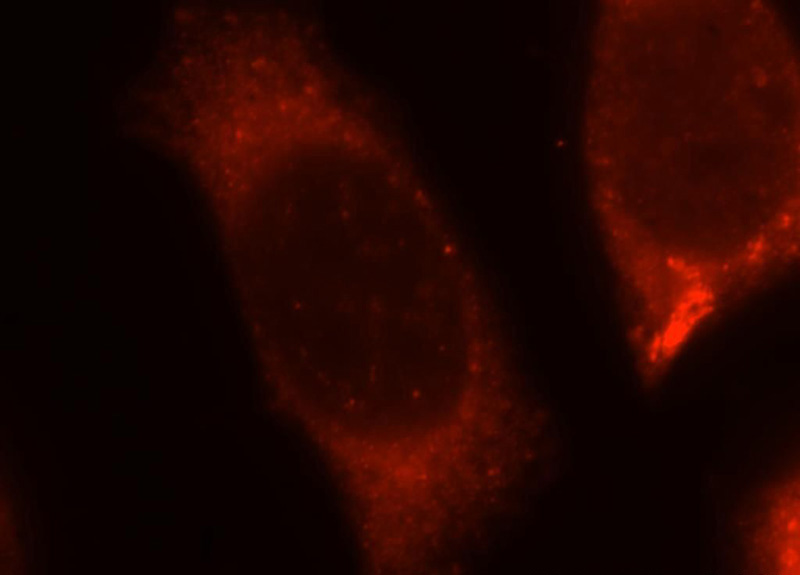 Immunofluorescent analysis of MCF-7 cells, using ABHD5 antibody Catalog No:107815 at 1:25 dilution and Rhodamine-labeled goat anti-rabbit IgG (red).