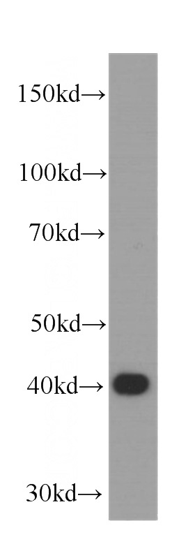 HEK-293 cells were subjected to SDS PAGE followed by western blot with Catalog No:107595(SMN1 antibody) at dilution of 1:1000