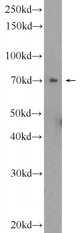 HepG2 cells were subjected to SDS PAGE followed by western blot with Catalog No:117022(ZNF695 Antibody) at dilution of 1:300