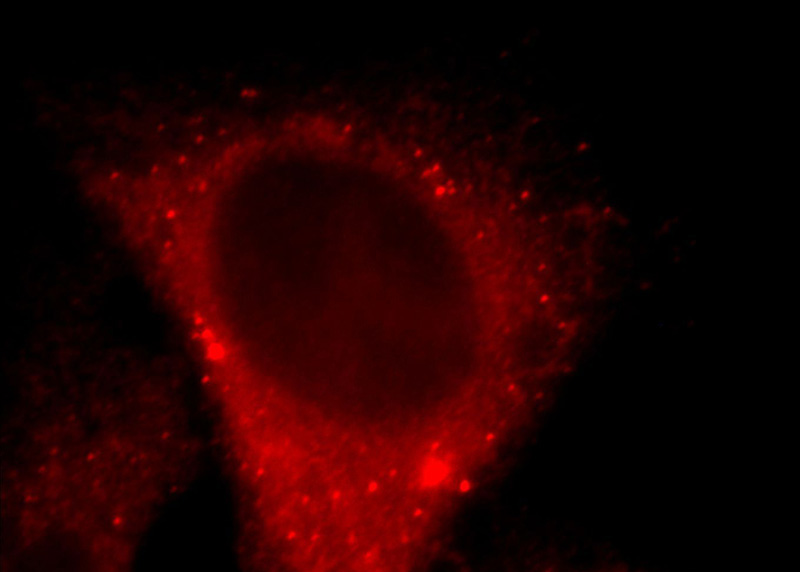 Immunofluorescent analysis of Hela cells, using FANCI antibody Catalog No:110520 at 1:25 dilution and Rhodamine-labeled goat anti-rabbit IgG (red).