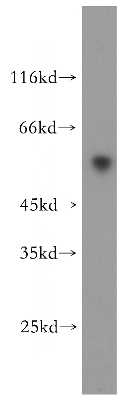 human heart tissue were subjected to SDS PAGE followed by western blot with Catalog No:115622(ST3GAL2 antibody) at dilution of 1:500