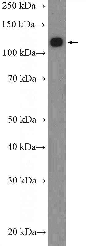 MCF-7 cells were subjected to SDS PAGE followed by western blot with Catalog No:108073(ANKRD27 Antibody) at dilution of 1:1000