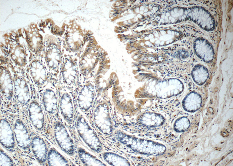 Immunohistochemistry of paraffin-embedded human colon tissue slide using Catalog No:110639(FGFBP3 Antibody) at dilution of 1:50 (under 10x lens)