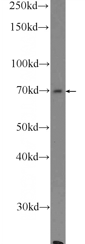 mouse liver tissue were subjected to SDS PAGE followed by western blot with Catalog No:107916(AGBL3 Antibody) at dilution of 1:300