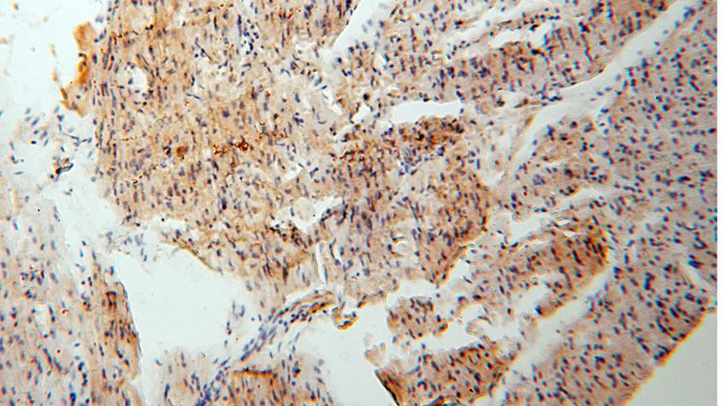 Immunohistochemical of paraffin-embedded human heart using Catalog No:116633(UQCR antibody) at dilution of 1:50 (under 10x lens)