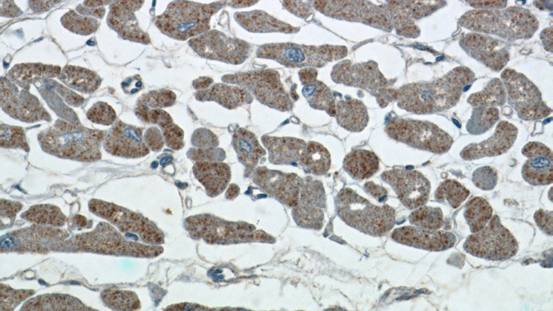 Immunohistochemistry of paraffin-embedded human heart tissue slide using Catalog No:109743(CUL3 Antibody) at dilution of 1:50 (under 40x lens)