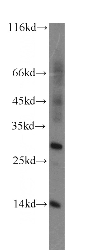 human liver tissue were subjected to SDS PAGE followed by western blot with Catalog No:114763(SAG antibody) at dilution of 1:500