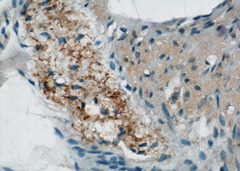Immunohistochemistry of paraffin-embedded human small intestine tissue slide using Catalog No:113256(NMU Antibody) at dilution of 1:50 (under 40x lens)