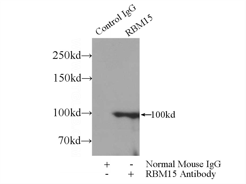 IP Result of anti-RBM15 (IP:Catalog No:107500, 3ug; Detection:Catalog No:107500 1:500) with HEK-293 cells lysate 1800ug.