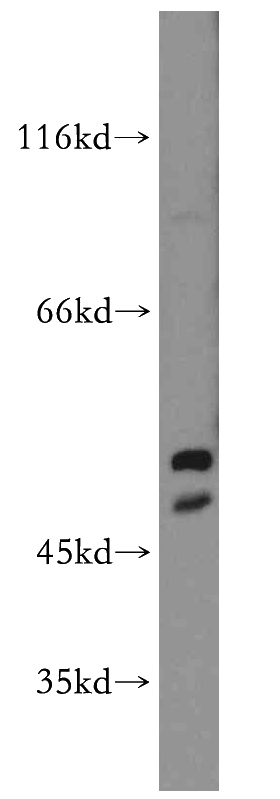 MCF7 cells were subjected to SDS PAGE followed by western blot with Catalog No:111257(HARS2 antibody) at dilution of 1:200