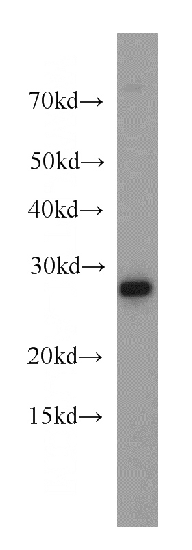 HeLa cells were subjected to SDS PAGE followed by western blot with Catalog No:109215(CHCHD6 antibody) at dilution of 1:500