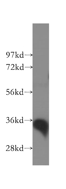 human kidney tissue were subjected to SDS PAGE followed by western blot with Catalog No:110870(GAS2 antibody) at dilution of 1:500
