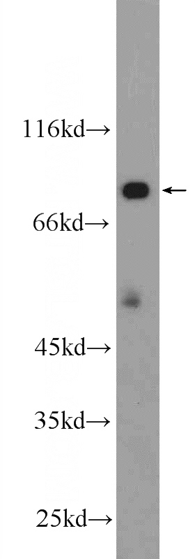 mouse brain tissue were subjected to SDS PAGE followed by western blot with Catalog No:111397(HECTD2 Antibody) at dilution of 1:1000