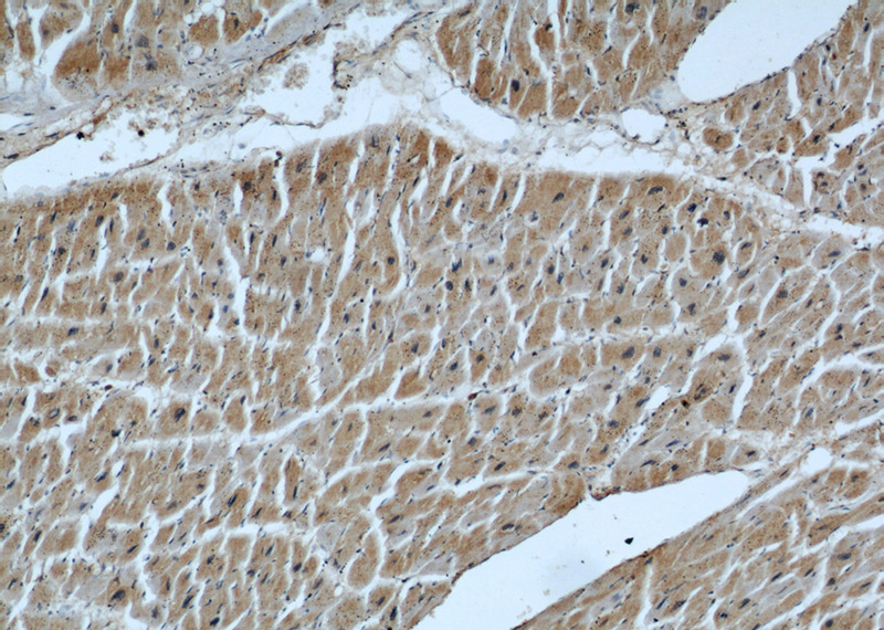 Immunohistochemical of paraffin-embedded human heart using Catalog No:107191(LIMA1 antibody) at dilution of 1:50 (under 10x lens)
