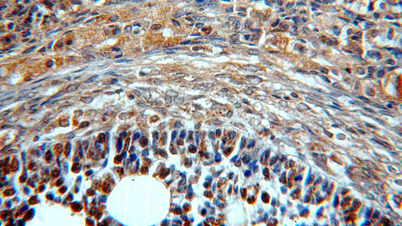 Immunohistochemical of paraffin-embedded human ovary using Catalog No:108543(BTG4 antibody) at dilution of 1:50 (under 40x lens)
