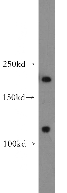 human skeletal muscle tissue were subjected to SDS PAGE followed by western blot with Catalog No:112882(MTUS1 antibody) at dilution of 1:500