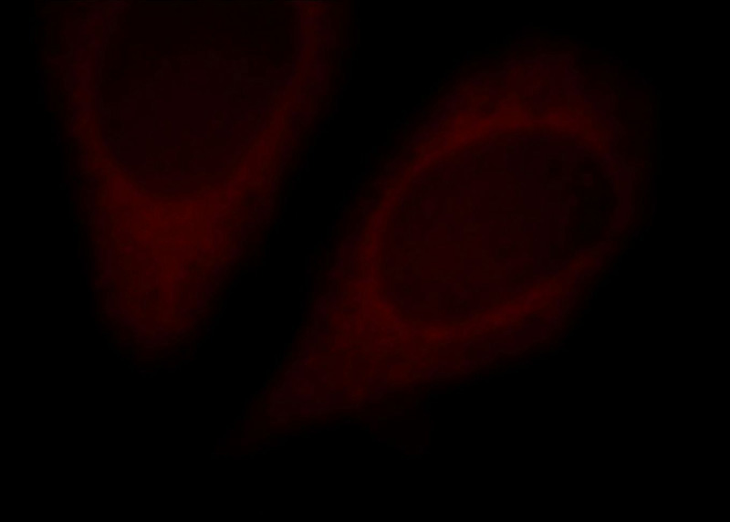 Immunofluorescent analysis of Hela cells, using SLC25A20 antibody Catalog No:115327 at 1:25 dilution and Rhodamine-labeled goat anti-rabbit IgG (red).