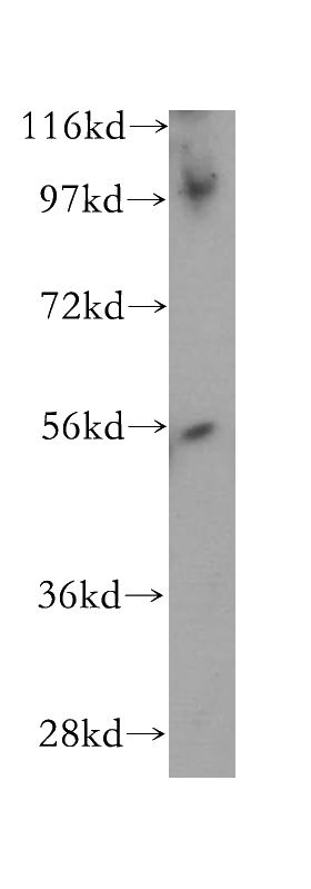 Jurkat cells were subjected to SDS PAGE followed by western blot with Catalog No:114347(PWP1 antibody) at dilution of 1:500
