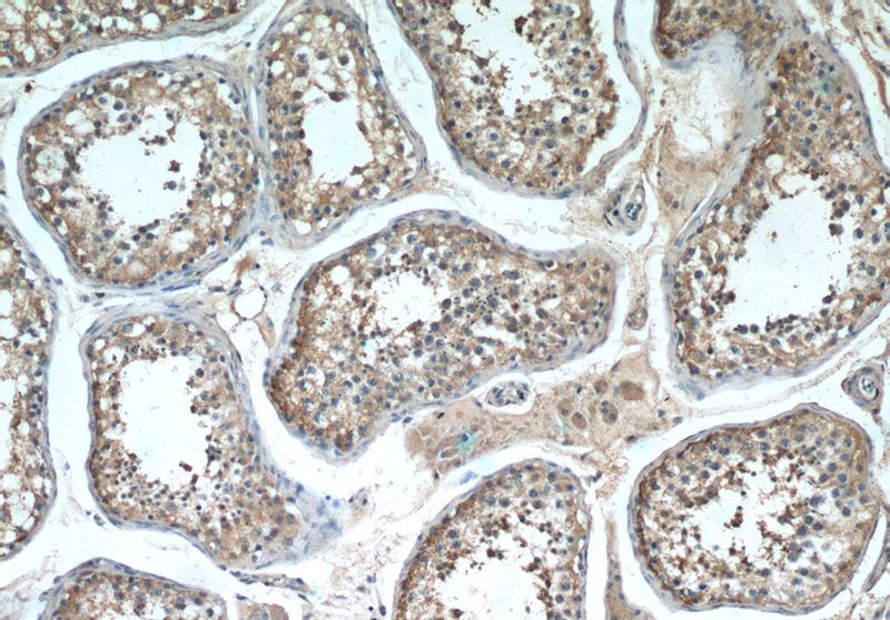 Immunohistochemistry of paraffin-embedded human testis tissue slide using Catalog No:111108(GPR123-Specific Antibody) at dilution of 1:50 (under 10x lens)