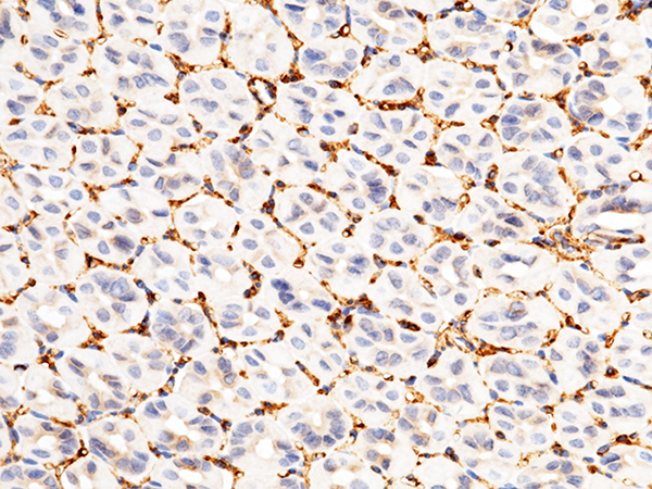CD146 / MCAM Antibody, Rabbit PAb, Antigen Affinity Purified, Immunohistochemistry