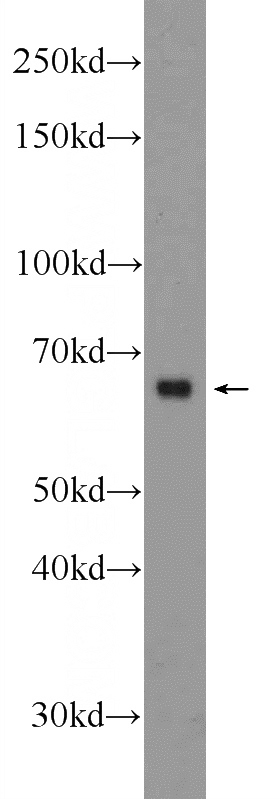 mouse kidney tissue were subjected to SDS PAGE followed by western blot with Catalog No:113506(OPN, SPP1 Antibody) at dilution of 1:1000