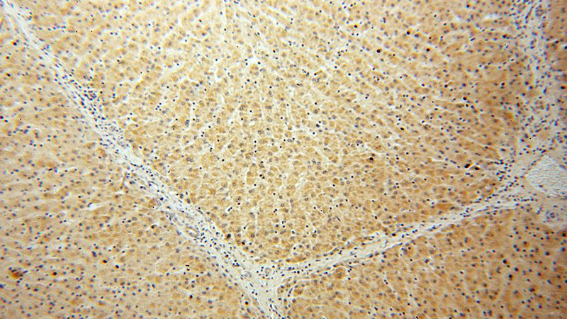 Immunohistochemical of paraffin-embedded human liver using Catalog No:114876(RPL21 antibody) at dilution of 1:100 (under 10x lens)