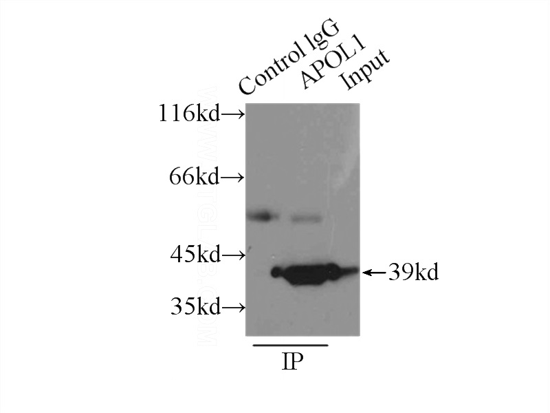 IP Result of anti-APOL1 (IP:Catalog No:108032, 3ug; Detection:Catalog No:108032 1:500) with HepG2 cells lysate 6000ug.